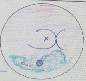 Right retina repairs - late July 2013