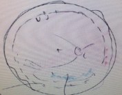 The light shading in this image represents the oil. The macula is in the middle.