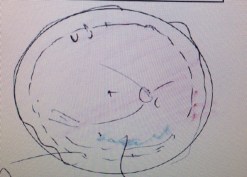 The sketch of my retina with shading that represents the oil.